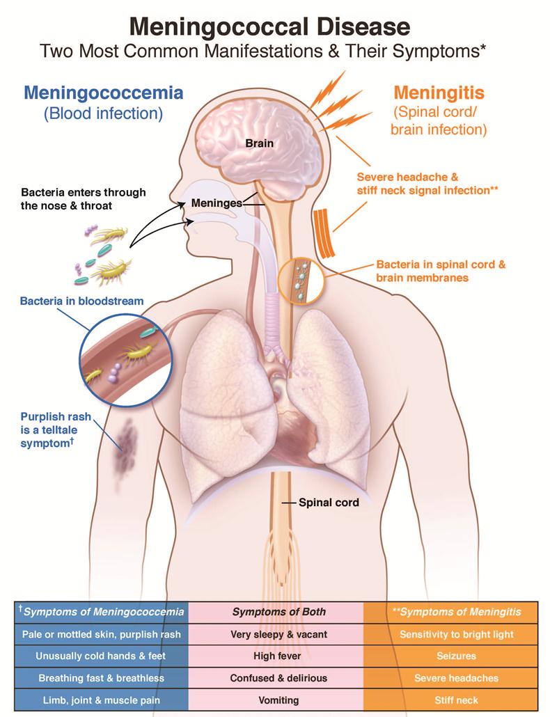 Symptoms Visual